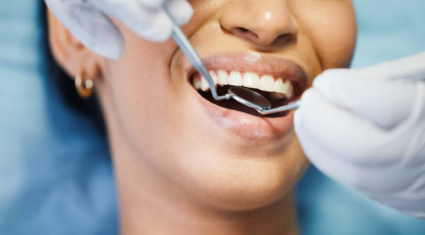 Best Emergency Dental Care for Trauma or Injury in Bloomingdale, NJ